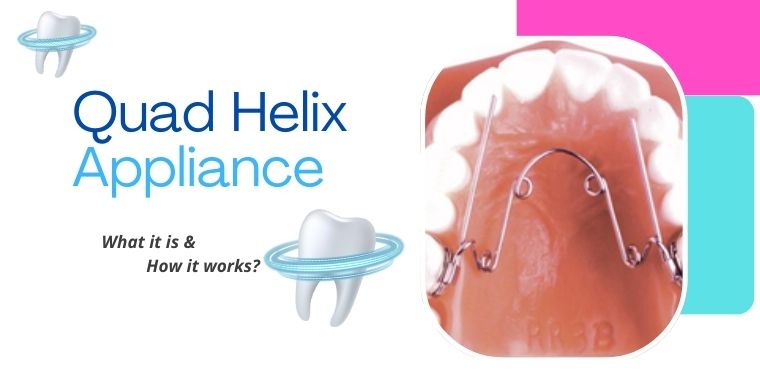 Quad Helix Appliance